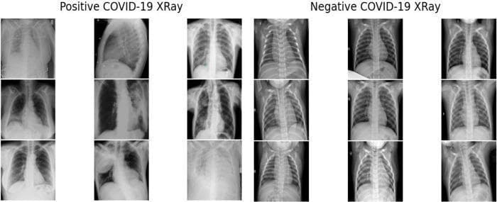 A comparison chart of chest x-ray (CXR) radiography samples, organized into two columns: 'Positive COVID-19 XRay' and 'Negative COVID-19 XRay.' The visual demonstrates the key diagnostic findings associated with viral pneumonia. The positive samples exhibit varying degrees of pulmonary pathology, including bilateral, patchy ground-glass opacities (GGO), reticular patterns, and areas of dense airspace consolidation, often with a peripheral or lower lobe predominance. These findings appear as hazy, white densities that obscure normal lung markings. In contrast, the negative COVID-19 samples show clear lung fields, well-defined costophrenic angles, and visible bronchovascular markings without evidence of acute infiltrates or consolidation. The image serves as an educational tool for identifying radiological manifestations of COVID-19 infection, specifically emphasizing the difference between normal thoracic anatomy and common patterns of pulmonary inflammation and alveolar filling observed in viral respiratory distress.