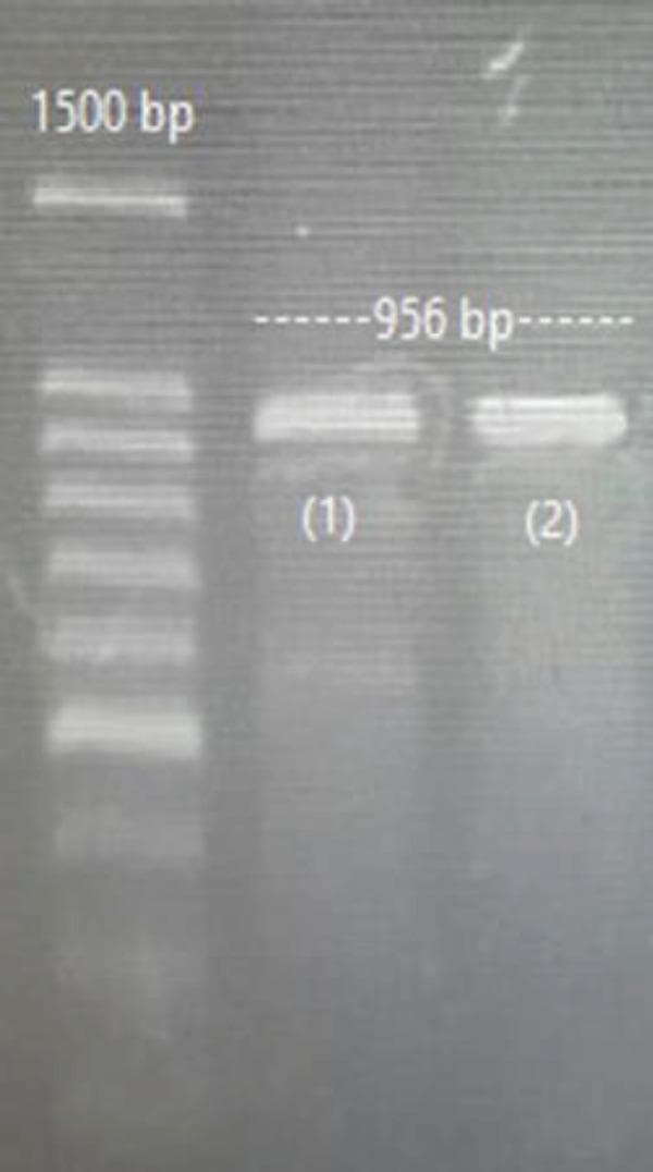 A diagnostic laboratory image showing agarose gel electrophoresis used in molecular biology research. The gel contains three primary lanes. On the far left, a molecular weight DNA ladder (marker) exhibits a series of distinct horizontal white bands used for size estimation, with a prominent band labeled at 1500 base pairs (bp). To the right are two experimental lanes labeled (1) and (2). Both lanes (1) and (2) show a single, clear, high-intensity horizontal band positioned slightly below the 956 bp reference line. The context indicates this represents the negative control for Peripheral Blood Mononuclear Cell (PBMC) transfection using a vector backbone. The uniformity in size and intensity of the bands in lanes (1) and (2) suggests consistent plasmid concentration and successful migration. This image is used to confirm the molecular size and integrity of genetic constructs during the development of CRISPR/Cas9-mediated PD-1 knockout protocols in human immune cells.