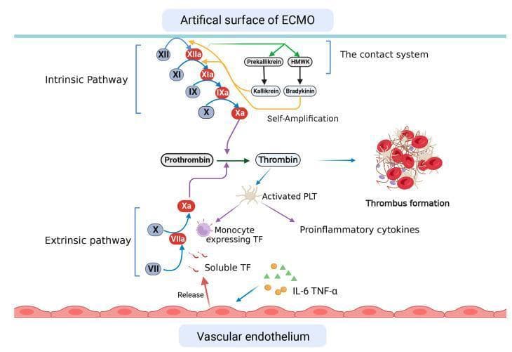 This pathophysiology diagram illustrates the dual activation of the coagulation cascade in patients undergoing Extracorporeal Membrane Oxygenation (ECMO). The diagram identifies two primary initiation mechanisms: contact with the artificial surface of the ECMO system and interactions with the vascular endothelium. The intrinsic pathway is triggered by the artificial surface, involving the contact system where Factor XII is activated to XIIa. This initiates a cascade (XIIa to XIa, XIa to IXa, and IXa to Xa) and a self-amplification loop involving Prekallikrein to Kallikrein and HMWK to Bradykinin. Concurrently, the extrinsic pathway is activated by soluble Tissue Factor (TF) released from the vascular endothelium and TF expressed on monocytes, leading to Factor VIIa activating Factor X to Xa. Both pathways converge at the common pathway, where Factor Xa converts Prothrombin to Thrombin. Thrombin subsequently leads to platelet activation (PLT), thrombus formation, and the release of proinflammatory cytokines, specifically IL-6 and TNF-α. The graphic serves as a clinical education tool for understanding the thrombotic and inflammatory risks associated with extracorporeal life support.
