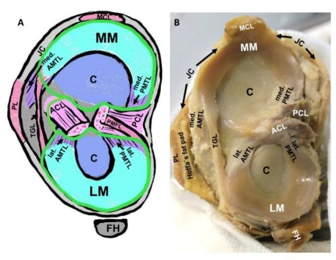 Educational visual showing the gross anatomy and schematic representation of the human tibial plateau and its intraarticular structures. The image is divided into a labeled schematic (A) and a corresponding clinical photograph of a cadaveric specimen (B), demonstrating the spatial relationships of the knee joint. Key anatomical features identified include the medial meniscus (MM) and lateral meniscus (LM) resting on the tibial articular cartilage (C). The cruciate ligaments—anterior (ACL) and posterior (PCL)—are shown centrally. Detailed focus is given to the meniscotibial ligaments, specifically the medial and lateral anterior meniscotibial ligaments (AMTL) and posterior meniscotibial ligaments (PMTL), which provide elastic fixation for the meniscal horns. Additional structures visible include the transverse genicular ligament (TGL) connecting the menisci, the medial collateral ligament (MCL), the joint capsule (JC), and the fibular head (FH). The schematic further illustrates the synovial membrane (green line) and its relation to the joint cavity. This material is designed to teach orthopedic anatomy, emphasizing the complex ligamentous network supporting knee joint stability and the entheses involved in degenerative conditions like osteoarthritis.