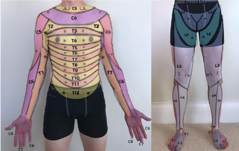 This clinical dermatome map, presented as an anatomical diagram overlaid on a human subject, illustrates the cutaneous sensory distribution of spinal nerves. The anterior trunk displays a sequential horizontal banding pattern representing thoracic dermatomes T2 through T12, with T4 roughly at the nipple line and T10 at the umbilicus. The upper extremities show cervical and upper thoracic distribution: C5 (lateral upper arm), C6 (lateral forearm and thumb), C7 (middle finger), C8 (medial hand and little finger), and T1 (medial forearm and arm). The lower extremity map details the lumbar and sacral levels: L1 (inguinal region), L2 (anterior mid-thigh), L3 (distal thigh and knee), L4 (medial lower leg), L5 (lateral lower leg and dorsal foot), and S1 (lateral foot and small toe). This resource is designed for primary care musculoskeletal medicine to assist in the neurological examination of sensory deficits, radiculopathy, or spinal cord injury level localization.