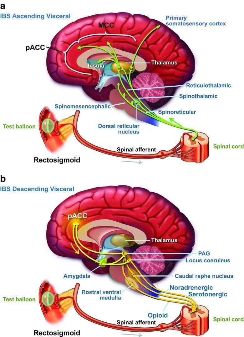 This medical illustration depicts the gut-brain axis through two comparative diagrams focusing on the neuroanatomical pathways of visceral perception and pain regulation in the context of Irritable Bowel Syndrome (IBS). Diagram (a) illustrates the ascending visceral pathway, where mechanical stimulation (represented by a test balloon in the rectosigmoid) triggers signals via spinal afferents to the spinal cord. These signals ascend through the spinomesencephalic, spinothalamic, and spinoreticular tracts to brain centers including the thalamus, insula, perigenual anterior cingulate cortex (pACC), midcingulate cortex (MCC), and primary somatosensory cortex. Diagram (b) outlines the descending visceral modulatory pathway, originating in the pACC and relaying through the amygdala, periaqueductal gray (PAG), and rostral ventral medulla. Descending noradrenergic, serotonergic, and opioid pathways project back to the spinal cord dorsal horn to modulate afferent signaling. The illustration serves as an educational tool for explaining how central nervous system processes can influence peripheral visceral sensitivity and the clinical rationale for using neuromodulators in disorders of gut-brain interaction.
