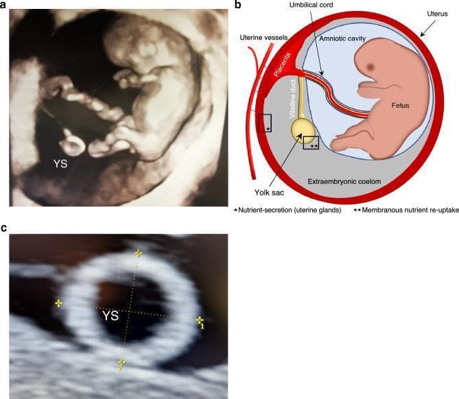 This composite educational graphic details first-trimester embryonic development and yolk sac (YS) anatomy. Panel (a) is a 3D ultrasound of a 10-week-old embryo, showing the echogenic fetus and its connection to the secondary yolk sac via the vitelline duct, set against hypoechoic amniotic fluid. Panel (b) provides a corresponding anatomical diagram illustrating the spatial relationship between the amniotic cavity containing the fetus and the extraembryonic coelom (exocoelomic cavity) housing the yolk sac. It highlights key structures including the placenta, umbilical cord, uterine vessels, and uterine glands. Labels indicate physiological processes like nutrient secretion from uterine glands and membranous re-uptake by the yolk sac. Panel (c) is a high-magnification 2D ultrasound demonstrating the clinical method for measuring yolk sac size using two perpendicular outer-to-outer diameters. The image serves as a reference for early obstetric imaging, fetal-maternal nutrient exchange mechanisms, and standard sonographic biometry during the first trimester.