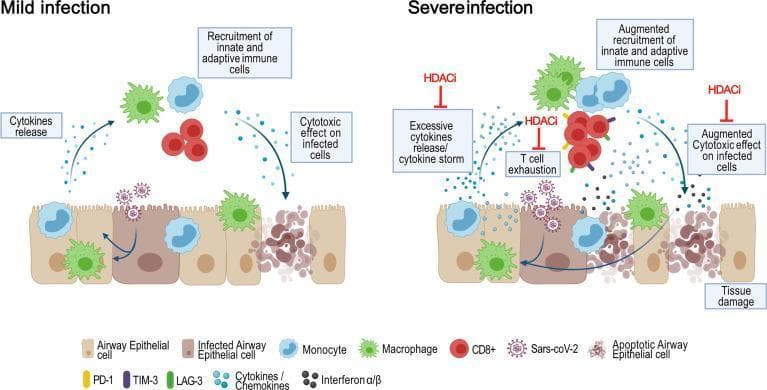 This pathophysiology diagram provides a comparative schematic of the immune response in 'Mild' versus 'Severe' COVID-19 (SARS-CoV-2) infection, highlighting potential therapeutic targets for Histone Deacetylase inhibitors (HDACi). The 'Mild infection' panel illustrates a controlled response where infected airway epithelial cells release cytokines and chemokines, recruiting innate (monocytes, macrophages) and adaptive (CD8+ T cells) immune cells. This results in targeted cytotoxicity and viral clearance. In contrast, the 'Severe infection' panel depicts a dysfunctional response characterized by a 'cytokine storm' (excessive cytokine release), augmented recruitment of immune cells, and significant T cell exhaustion (indicated by PD-1, TIM-3, and LAG-3 markers). This severe state leads to widespread apoptosis of airway epithelial cells and systemic tissue damage. The diagram identifies specific points where HDACi can intervene to modulate the pathology: inhibiting excessive cytokine release, reducing T cell exhaustion, and mitigating augmented cytotoxic effects on lung tissue. Key signaling molecules shown include Type I interferons (IFN ̑α/β) and various pro-inflammatory cytokines.