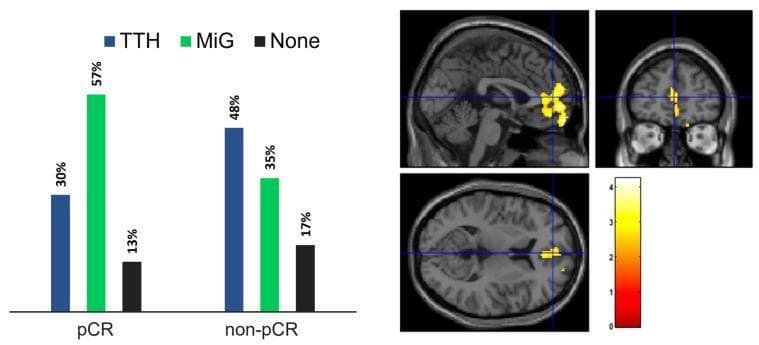 This composite educational graphic consists of a side-by-side comparison between a clinical bar chart and neuroimaging statistical maps. On the left, a grouped bar graph illustrates the distribution of headache types—Tension-Type Headache (TTH), Migraine (MiG), and No Headache (None)—in cancer patients categorized by their pathological complete response (pCR) to neoadjuvant chemotherapy (NAC). The pCR group shows a predominance of Migraine (57%), while the non-pCR group shows a higher prevalence of TTH (48%). On the right, a statistical map overlay on a T1-weighted MRI template displays regions of altered brain metabolism in sagittal, coronal, and axial views. Yellow-red clusters indicate a positive test statistic (intensity scale 0 to 4) localized predominantly in the bilateral anterior medial frontal cortex. The visual highlights a specific neuro-oncological correlation between chemotherapy response clinical outcomes and functional brain imaging biomarkers, specifically targeting metabolic variations in patients suffering from different primary headache disorders.