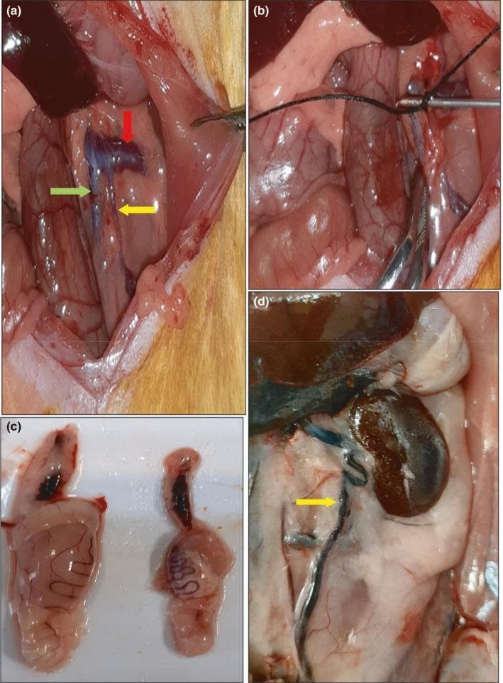 This composite of four clinical photographs illustrates the surgical induction and subsequent morphological effects of an experimental varicocele model in a rat, serving as a surrogate for human urological pathology. Panels (a) and (b) show the intra-abdominal surgical site: (a) demonstrates normal vascular anatomy including the left renal vein (red arrow), the left spermatic vein (yellow arrow), and the inferior vena cava (green arrow); (b) depicts the partial ligation of the left renal vein using a suture and metal probe to induce venous hypertension. Panel (c) presents a side-by-side comparison of dissected testes, showing significant testicular atrophy on the right (varicocele group) compared to the healthy control on the left. Panel (d) displays the resulting clinical manifestation in situ, specifically a distended and tortuous left internal spermatic vein (yellow arrow). The collection illustrates the pathophysiology of varicocele, highlighting the relationship between proximal venous obstruction, distal venous dilation (varicosity), and consequent testicular hypotrophy.
