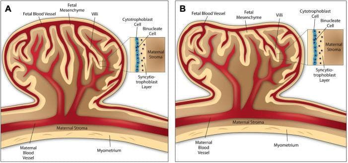 This comparative anatomical diagram illustrates the structural morphology of ruminant placentomes, serving as an animal model for studying placental development and human pregnancy complications. Diagram A depicts the cow placentome, characterized by a convex structure where the fetal cotyledon and maternal caruncle interface in an outward-bulging arrangement. Diagram B shows the sheep placentome, which exhibits a concave morphology with an inward-curving indentation at the fetal-maternal interface. Both diagrams detail the internal architecture, including fetal blood vessels, fetal mesenchyme, and villi. High-magnification callouts highlight the cellular layers forming the synepitheliochorial placenta: a layer of mononuclear cytotrophoblast cells adjacent to binucleate cells, and the syncytiotrophoblast layer which facilitates direct contact with the maternal stroma. The diagrams also delineate the maternal environment, showing the maternal blood vessels, stroma, and the underlying myometrium. This visual resource is used to teach concepts of comparative placentation, trophoblast differentiation, and the spatial relationships within the maternal-fetal unit.