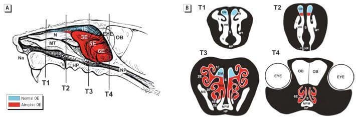 This educational illustration provides a diagrammatic representation of the murine nasal passage, highlighting the topographical distribution of normal and atrophic olfactory epithelium (OE). Panel A shows a sagittal view of the right nasal passage with the septum removed, exposing the lateral wall. It labels key structures including the naris (Na), maxilloturbinate (MT), nasoturbinate (N), ethmoid turbinates (1E–6E), hard palate (HP), and nasopharynx (NP). Vertical lines T1–T4 indicate specific transverse tissue block levels used for microscopic analysis. Panel B displays corresponding cross-sections for T1–T4, illustrating the complex scroll-like architecture of the turbinates and airway meatuses (dorsal, middle, and ventral). A color-coded legend distinguishes Normal OE (blue), primarily located in the dorsomedial regions, from Atrophic OE (red), which is prominently visible in the caudal ethmoid turbinates (3E–6E) and ventral regions in T3 and T4. This diagram is used to demonstrate localized toxicological injury and subsequent neuroepithelial atrophy within the olfactory system, reaching back to the level of the olfactory bulbs (OB) and eyes.