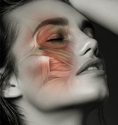 This medical illustration features a semi-transparent schematic overlay of facial musculature onto a monochrome clinical photograph of a human face. The primary focus is the orbicularis oculi muscle, depicted with a distinctive circular, striated fiber pattern that surrounds the orbital rim and extends from the eyebrow to the upper cheek and lower eyelid. The diagram highlights the muscle's superficial position in the periocular region. Adjacent facial muscles, including the zygomaticus major and minor and levator labii superioris, are shown extending across the midface and cheek area, illustrating the complex, overlapping anatomical relationships between the periocular and midfacial soft tissues. This visual is designed for educational instruction on facial anatomy, specifically addressing the soft tissue components involved in eye movement, wrinkle formation, and clinical conditions such as periocular dark circles (dark eye circles) and eyelid edema. It demonstrates the anatomical basis for cosmetic and therapeutic interventions targeting the facial nerve branches and orbicularis oculi.