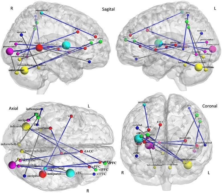 This functional connectivity diagram illustrates deception-modulated neural networks within a semi-transparent 3D brain model, shown in Sagittal (Right and Left), Axial, and Coronal views. Brain regions are represented as color-coded spheres (nodes) indicating six functional communities: Red (Cingulo-opercular network, including aPFC and dACC), Green (Fronto-parietal network), Dark Blue (Default mode network), Light Blue (Sensorimotor network), Purple (Occipital network), and Yellow (Cerebellum). Lines (edges) represent functional connectivities between these nodes. Blue lines indicate stronger functional connections, specifically showing positive modulation (increased connectivity) during lie-telling, while gray lines represent weaker or negatively modulated connections. Notable long-range connections are visible between the anterior prefrontal cortex (aPFC) and the cerebellum and occipital regions. This visualization highlights the distributed, multi-network nature of executive control and cognitive processes associated with deception, emphasizing the interplay between frontal control regions and posterior sensory/cerebellar networks.