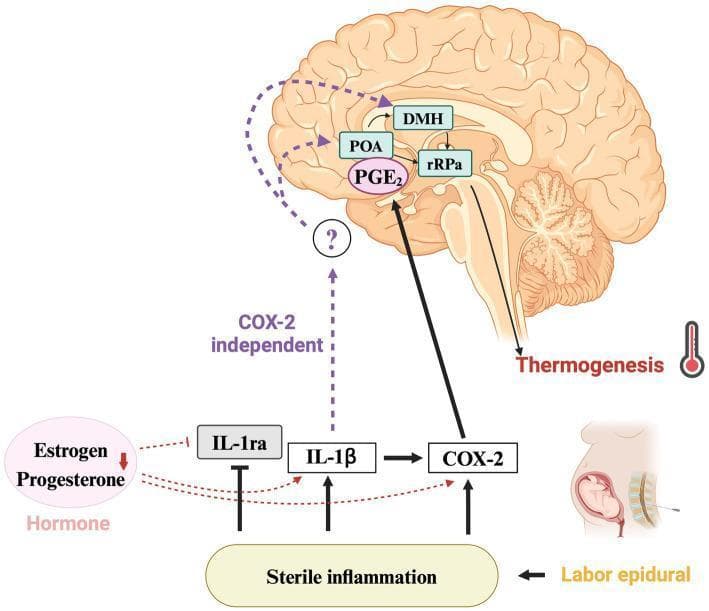 This pathophysiology diagram illustrates the thermoregulatory pathway implicated in epidural-related maternal fever (ERMF). The visual is divided into a molecular/hormonal section and a neuroanatomical section within a midsagittal view of the human brain. The lower portion depicts that 'Labor epidural' triggers 'Sterile inflammation,' which increases levels of IL-1̠ and COX-2 while suppressing the anti-inflammatory cytokine IL-1ra. Simultaneously, declining levels of estrogen and progesterone further inhibit IL-1ra and promote IL-1̠ and COX-2 expression. In the neuroanatomical section, the pathway shows PGE2 acting upon the preoptic area (POA), which then signals the dorsomedial hypothalamus (DMH). The DMH projects to the rostral raphe pallidus (rRPa) in the brainstem, ultimately leading to thermogenesis. A dashed line representing a COX-2 independent pathway from IL-1̠ to the hypothalamus is marked with a question mark, indicating a mechanism under investigation. This diagram serves as an educational tool for understanding the endocrine and immunological modulation of the central nervous system's febrile response during childbirth.
