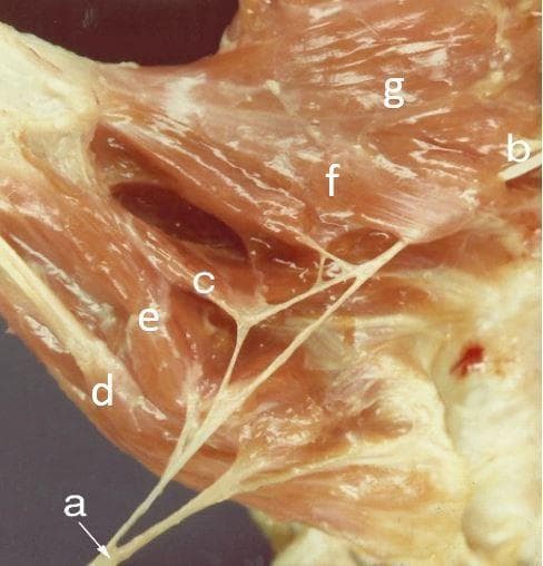 Anatomical cadaveric dissection photograph showing the muscular and nervous structures of the human thenar eminence and palmar hand. The image demonstrates the innervation and spatial relationships of the intrinsic thumb muscles. Key identified structures include the median nerve (a) branching to supply the abductor pollicis brevis (d), the superficial head of the flexor pollicis brevis (e), and the deep head of the flexor pollicis brevis (c), the latter illustrating dual innervation. To the right, the deep branch of the ulnar nerve (b) is visible near the oblique (f) and transverse (g) heads of the adductor pollicis muscle. The dissection highlights the layered arrangement of the thenar muscles and the complex branching patterns of the recurrent branch of the median nerve and the deep branch of the ulnar nerve. This clinical educational material is intended for advanced musculoskeletal anatomy and neurovascular surgical training.