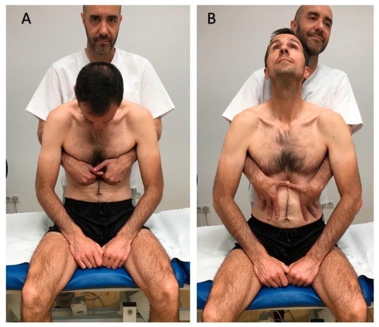 Two-panel clinical photograph demonstrating a visceral osteopathic manual technique targeting the lower esophageal sphincter, typically used for gastroesophageal reflux disease (GERD). Panel A (Initial Position) shows a male patient seated upright on a treatment table in spinal flexion with his neck flexed and head looking down. A practitioner stands behind him with hands placed horizontally in the epigastric region, specifically contacting the area just inferior to the costal margins. Panel B (Final Position) illustrates the completion of the maneuver: the patient has moved into spinal extension with his neck extended and gaze upward. Simultaneously, the practitioner has shifted hand placement to apply caudal (downward) pressure within the epigastrium. The visual demonstrates the coordination of patient respiratory/postural movement with manual tissue mobilization by the therapist. This procedural image is intended for medical students and physical therapy or osteopathic practitioners to understand the manual application and patient positioning for visceral abdominal therapy.