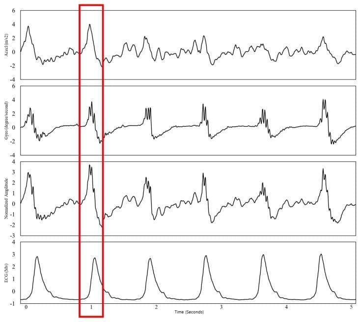 This physiological signal diagram illustrates the temporal correlation between mechanical and electrical cardiac activity over a 5-second interval. The figure consists of four vertically stacked, time-synchronized plots sharing a common horizontal axis (Time in Seconds). From top to bottom, the waveforms represent: 1) Accelerometer data (Accel in m/s²), 2) Gyroscope data (Gyro in degrees/second), 3) Normalized Amplitude (representing the ensemble averaging of the motion sensors), and 4) Electrocardiogram (ECG in mV). A vertical red box highlights a specific epoch around the 1-second mark, demonstrating that the mechanical peaks in the seismocardiogram (SCG) and gyrocardiogram (GCG) signals correspond directly with the R-wave peak of the ECG. This visualization is used to demonstrate the efficacy of multi-axis MEMS sensors in capturing cardiac-induced chest vibrations and their synchronization with the heart's electrical cycle, which is essential for non-invasive heart rate monitoring and hemodynamic assessment.