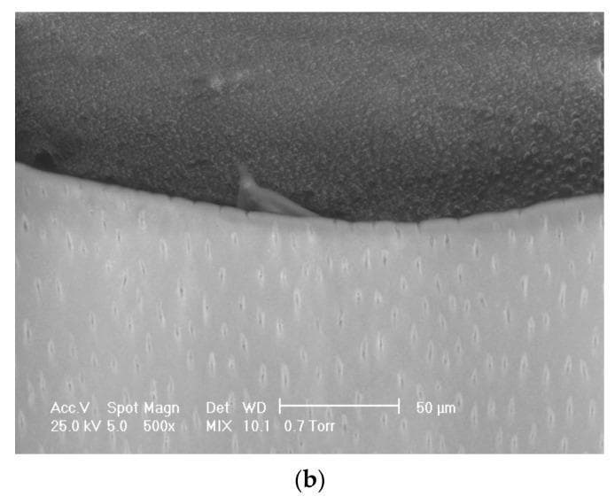 This Scanning Electron Microscopy (SEM) diagnostic image at 500x magnification illustrates the adhesive-dentin interface in a restorative dental specimen. The image is divided into two distinct regions. The lower portion (lighter tone) represents the dentin layer, characterized by a high density of evenly distributed, elongated dentinal tubules or canaliculi. These tubules appear as small, dark, vertically oriented ovals within a smooth calcified matrix. The upper portion (darker tone) depicts the dental adhesive material, showing a granular and homogeneous texture. The interface between the two materials is clearly defined, demonstrating clinical evidence of hybridization. At one point along the boundary, the adhesive material can be seen interpenetrating a dentinal tubule, indicating the formation of a resin tag for micromechanical retention. The image is critical for evaluating the quality of dental bonding, the presence of a hybrid layer, and the potential for microleakage in restorative dentistry.