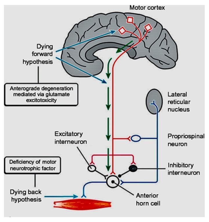 A pathophysiology diagram illustrating the competing hypotheses for neurodegeneration in Amyotrophic Lateral Sclerosis (ALS). The illustration includes a sagittal view of the human brain and the spinal motor circuit. The 'Dying forward hypothesis' is depicted as originating in the motor cortex, showing anterograde degeneration mediated via glutamate excitotoxicity (indicated by green downward arrows). This pathway highlights the involvement of upper motor neurons and their corticofugal projections. In contrast, the 'Dying back hypothesis' is shown starting at the muscle level, suggesting retrograde degeneration caused by a deficiency of motor neurotrophic factors at the neuromuscular junction. The diagram details the lower motor neuron environment, including the anterior horn cell, excitatory and inhibitory interneurons, propriospinal neurons, and the lateral reticular nucleus. This educational graphic serves to differentiate between top-down (cortical) and bottom-up (peripheral) mechanisms of motor neuron disease progression.