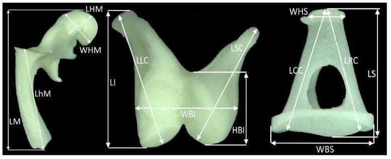Anatomical comparison and morphometric analysis of the three auditory ossicles from the middle ear: the malleus, incus, and stapes. The image displays the bones individually against a dark background, highlighted with white arrows and abbreviations indicating specific linear and width measurements.
1. Malleus (Left): Demonstrates measurements for total length (LM), length and width of the head (LHM, WHM), and length of the handle or manubrium (LhM).
2. Incus (Middle): Resembles a molar tooth with measurements for total length (LI), length of the long crus (LLC), length of the short crus (LSC), and the height and width of the body (HBI, WBI).
3. Stapes (Right): A stirrup-shaped bone showing total length (LS), length of the caudal and rostral crura (LCC, LRC), width of the head (WHS), and width of the base/footplate (WBS).
This diagram serves as a morphometric guide for identifying structural landmarks and quantifying the size proportions of the ossicular chain used in comparative anatomy and audiological research.