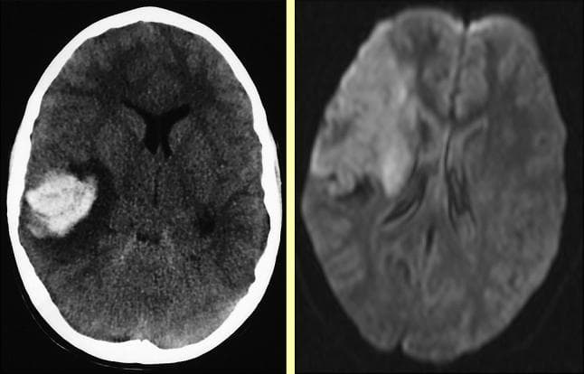 Hugging Face pmc clinical VQA raw