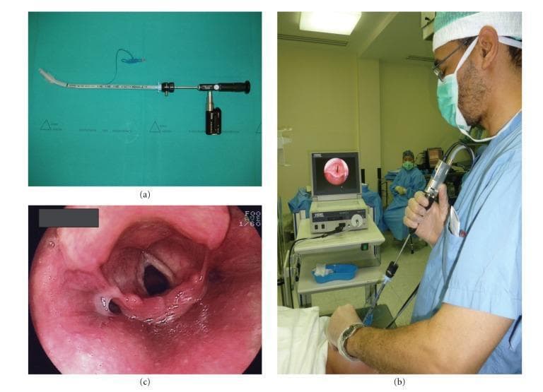 This composite educational image illustrates the components and clinical application of the Bonfils Intubation Fiberscope (BIF) in anesthesiology. Panel (a) shows the medical hardware: a rigid, straight silver/grey fiberscope with a distal curved tip, armed with a 7.5 mm inner diameter endotracheal tube. Key features include measurement graduations on the insertion shaft and a black handle with an attached battery power source or camera module. Panel (b) depicts an intraoperative clinical scenario where a practitioner in surgical attire performs a video-assisted intubation. The BIF is held at the eyepiece, with the live feed displayed on an external monitor. Panel (c) provides an endoscopic view of the laryngeal aditus obtained during the procedure. It displays anatomical landmarks including the vocal cords forming a glottic opening, the epiglottis, and surrounding aryepiglottic folds. The mucosal tissue appears pink and moist with visible vascularity. This image serves as a teaching tool for difficult airway management and the technical setup of rigid fiberoptic intubation devices.