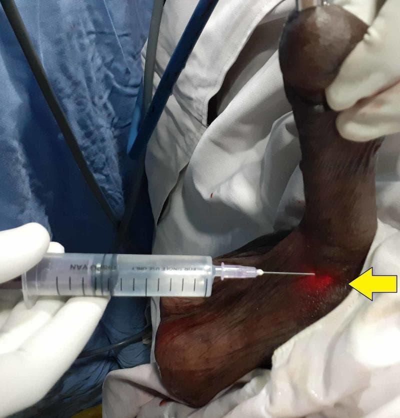Hugging Face pmc clinical VQA raw