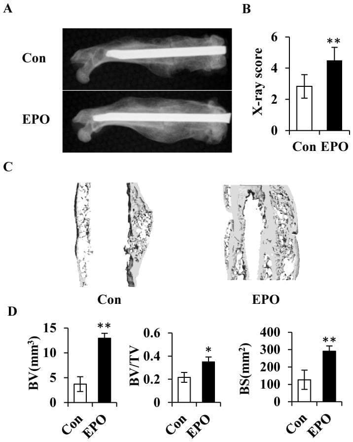 Educational panel illustrating the effect of Erythropoietin (EPO) on bone fracture healing at day 28 post-surgery in a femur model. (A) Radiological Comparison: Lateral X-rays of the femur showing a control (Con) group and an EPO-treated group. The EPO-treated femur demonstrates a more robust, radiopaque bony callus at the fracture site compared to the control. (B) Bar Graph: Quantitative X-ray scores indicating a significantly higher healing score for the EPO group (p < 0.01). (C) Micro-CT Analysis: 3D micro-computed tomography reconstructions of the new bone regenerates. The EPO images show increased bone bridging, greater spatial distribution of mineralized tissue, and a more complex trabecular network than the control. (D) Quantitative Histomorphometry: Three bar graphs showing significant increases (p < 0.05 or p < 0.01) in bone microstructure parameters for the EPO group, including bone volume (BV), bone volume/total volume (BV/TV), and bone surface (BS). The content demonstrates EPO's role as a pro-osteogenic factor in enhancing bone consolidation and mineral density during orthopedic repair.