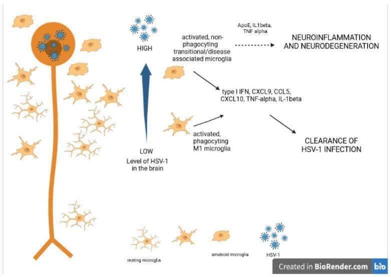 This pathophysiology diagram illustrates the relationship between Herpes Simplex Virus type 1 (HSV-1) brain infection and microglia morphological states. It depicts a spectrum of microglia transformation from highly branched 'resting microglia' to 'ameboid microglia' in response to infection. The diagram bifurcates based on viral load: a 'LOW' level of HSV-1 triggers 'activated, phagocyting M1 microglia' which secrete cytokines and chemokines including type I IFN, CXCL9, CCL5, CXCL10, TNF-alpha, and IL-1beta, leading to the 'CLEARANCE OF HSV-1 INFECTION'. Conversely, a 'HIGH' level of HSV-1 results in 'activated, non-phagocyting transitional/disease associated microglia' (DAM). This state is associated with ApoE, IL-1beta, and TNF-alpha, and is linked to chronic 'NEUROINFLAMMATION AND NEURODEGENERATION'. The visual serves as an educational model for understanding how varying intensities of viral stimuli can shift immune responses from protective phagocytosis to pathological neurodegeneration in the central nervous system.