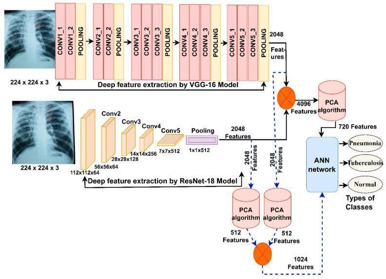 This medical flow diagram illustrates a deep learning architecture for the differential diagnosis of pneumonia and tuberculosis using chest X-rays. The technical algorithm utilizes two parallel feature extraction pathways: a VGG-16 model and a ResNet-18 model. Each model processes an input X-ray image (224x224x3) into 2048 deep features. The VGG-16 pathway details sequential convolutional layers (CONV1_1 through CONV5_3) interspersed with pooling layers, while the ResNet-18 pathway shows its specific block architecture (Conv2 to Conv5). Following feature extraction, two data processing routes are depicted. The first route merges features into a 4096-feature vector, which is then reduced to 720 features via Principal Component Analysis (PCA). The second route applies independent PCA to each model's features (reducing to 512 each) before combining them into a 1024-feature vector. Both routes converge at an Artificial Neural Network (ANN) for final classification. The clinical output categorizes findings into three distinct classes: Pneumonia, Tuberculosis, or Normal. This flowchart highlights advanced diagnostic informatics for respiratory infectious diseases.
