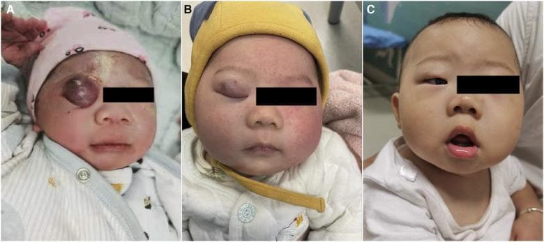 Hugging Face pmc clinical VQA raw