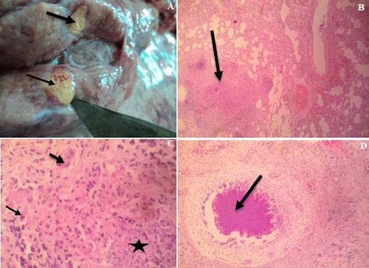 This composite figure illustrates the gross and microscopic pathology of systemic granulomatous inflammation, characteristic of tuberculosis. Panel A shows a gross clinical photograph of a dissected mediastinal lymph node, featuring yellowish, firm-to-hard nodules (arrows) indicating caseation. Panels B, C, and D are hematoxylin and eosin (H&E) stained photomicrographs. Panel B (40x) depicts a large granuloma within lung parenchyma. Panel C (400x) provides a high-magnification view of a lung nodule, identifying a central zone of amorphous caseous necrosis (star) surrounded by a cellular infiltrate of lymphocytes and macrophages, with prominent multinucleated giant cells (arrows) at the periphery. Panel D (100x) shows a splenic granuloma with a distinct central area of caseous necrosis (arrow). Together, these images demonstrate the hallmarks of Mycobacterium-induced infection, including central necrosis, Langhans-type giant cells, and the organized structure of a granuloma across multiple organ systems.
