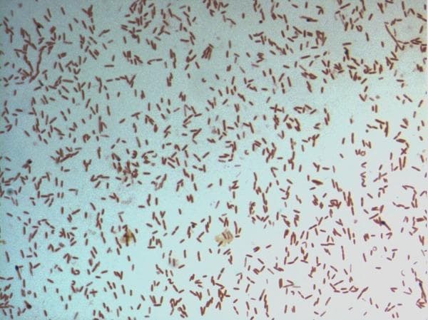 This diagnostic image shows a light microscopy view of a bacterial culture following Gram staining. The specimen displays numerous small, rod-shaped (bacilli) bacteria distributed across the field. The microorganisms exhibit a consistent pink-to-red hue, identifying them as Gram-negative. This staining characteristic indicates a cell wall structure with a thin peptidoglycan layer and an outer membrane that does not retain the crystal violet stain. The arrangement of the bacilli is predominantly individual or scattered, with occasional small clusters and pairs. Specifically identified as D. fastidiosa strain JC13T, this image serves as a primary microbiological reference for the morphological and staining properties of this novel genus within the family Erysipelotrichaceae. The visual demonstrates key diagnostic features including cell morphology, arrangement, and Gram reaction, which are essential for clinical microbiology classification and initial pathogen identification.