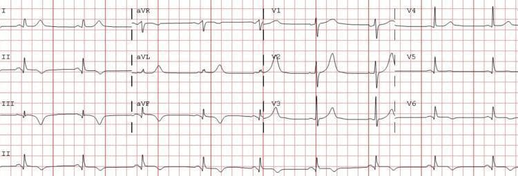 Hugging Face pmc clinical VQA raw