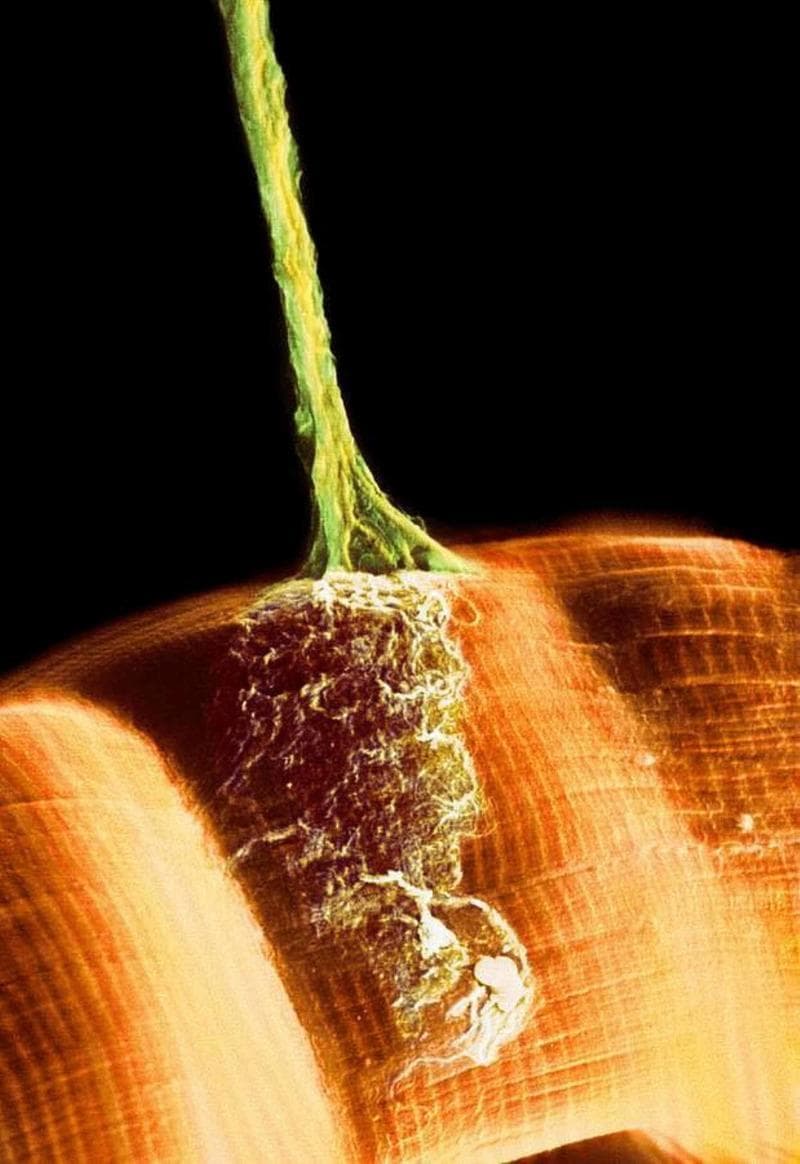 This false-color scanning electron micrograph (SEM) illustrates the morphology of a neuromuscular junction. A single motor axon, depicted in green, descends from the top of the frame to contact a skeletal muscle fiber, shown in orange. The axon exhibits a long, cylindrical structure that tapers and subsequently branches as it approaches the muscle surface. At the terminal end, the axon expands into a complex, granular network of synaptic terminals or motor endplates, which spread across a localized region of the muscle sarcolemma. The muscle fiber displays prominent transverse striations, characteristic of sarcomere organization in skeletal muscle. This visual demonstrates the physical connection between the somatic nervous system and the muscular system, highlighting the site of chemical neurotransmission and the structural adaptation of synapses to maximize contact area with the muscle cell for effective motor signaling.
