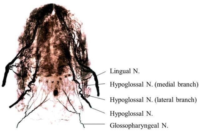 This diagnostic image demonstrates the whole-mount neural anatomy of a human adult tongue using Sihler’s staining technique. This specialized clear-and-stain method renders muscle tissue translucent while staining nerve fibers dark, allowing for precise visualization of the three-dimensional intramuscular nerve distribution. The image displays the relative positions and branching patterns of key cranial nerves. The Lingual Nerve (branch of CN V3) is visible providing sensory innervation to the anterior two-thirds. The Hypoglossal Nerve (CN XII) is shown with its medial and lateral branches situated between the more lateral Lingual Nerve and the more medial/inferior Glossopharyngeal Nerve (CN IX) in the posterior tongue. The anatomical mapping highlights the complex plexus formation and terminal branching critical for coordinating sensorimotor functions such as deglutition and speech. This visual serves as a primary reference for understanding the dense innervation patterns required for motor control by CN XII and sensory perception by CN IX and CN V.