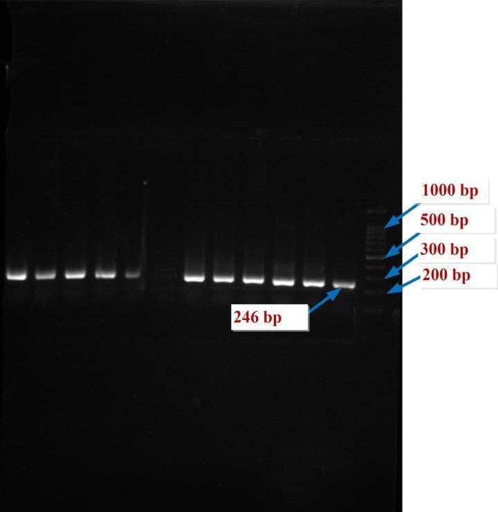 This diagnostic image shows an agarose gel electrophoresis of PCR products related to the HPA-5 gene in a study of human platelet antigens. The gel features multiple vertical lanes displaying bright DNA bands against a dark background, typical of ethidium bromide or similar staining. The rightmost lane contains a DNA ladder with marked reference points at 1000 bp, 500 bp, 300 bp, and 200 bp. The experimental lanes display highly homogeneous, singular bands indicating successful target amplification. A specific label points to a band at 246 bp, representing the expected size of the PCR product for the HPA-5 allele. This molecular diagnostic technique is used in hematology to determine genotype frequencies in patients, such as those with Glanzmann Thrombasthenia, to assess genetic susceptibility to treatment resistance or platelet alloimmunization. The clear, sharp bands suggest high specificity and concentration of the amplified DNA fragments.