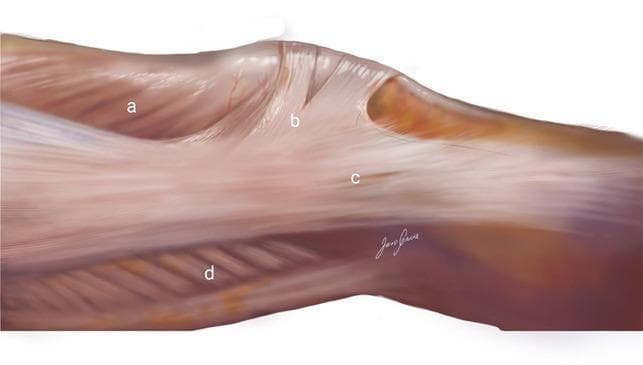 Anatomical illustration of the lateral aspect of the human knee, specifically depicting the superficial fascia and musculature. The diagram uses alphabetical labels to identify key structures: (a) refers to the vastus lateralis muscle, showing its characteristic pennate fiber arrangement; (b) indicates the superficial oblique retinaculum, also known as arciform fibers, which appear as distinct, vertically oriented translucent bands crossing toward the lateral patella; (c) denotes the superficial layer of the iliotibial band (ITB), a dense, longitudinally oriented fibrous sheet that provides lateral stability and inserts onto Gerdy’s tubercle; and (d) identifies the biceps femoris muscle on the posterior-lateral border. The illustration highlights the complex integration between the ITB, the quadriceps extensor mechanism, and the lateral patellar retinaculum, emphasizing the functional anatomy of the lateral patellofemoral complex relevant for orthopedics and sports medicine education.