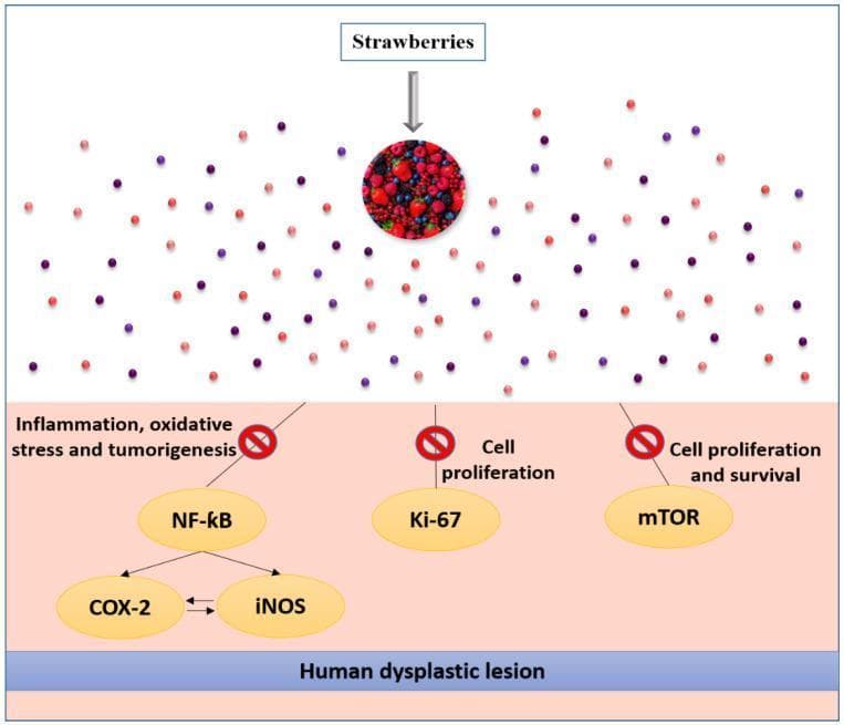 This pathophysiology diagram illustrates the chemopreventive mechanisms of strawberries in inhibiting the progression of human esophageal dysplastic lesions. The visual flow begins at the top with 'Strawberries' and a circular collage of berries, which release small red and purple spheres representing bioactive compounds like anthocyanins and phenolic acids. These components act on a biological field representing esophageal tissue. The diagram highlights three specific pathways inhibited by these compounds, each marked with a red 'prohibited' (null) sign to signify downregulation or suppression: 1) Inflammation, oxidative stress, and tumorigenesis, which involves the NF-kB signaling pathway and its downstream mediators COX-2 and iNOS; 2) Cell proliferation, specifically targeting the marker Ki-67; and 3) Cell proliferation and survival, mediated through the mTOR pathway. These pathways are depicted as yellow ovals connected by arrows to show hierarchy and interaction. The bottom of the image features a blue horizontal bar labeled 'Human dysplastic lesion,' indicating the clinical target of these strawberry-derived inhibitory effects in preventing esophageal squamous cell carcinoma.