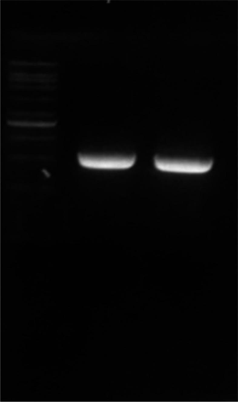 This diagnostic image is an electrophoregram (agarose gel electrophoresis) showing the results of Polymerase Chain Reaction (PCR) amplification. The image contains three lanes visualized under UV light. On the far left, a 1 kb DNA ladder serves as a molecular weight marker, displaying approximately eight discrete horizontal bands of varying intensity. In the two rightmost lanes, there are clear, thick, high-intensity bands representing amplified DNA fragments. These specific bands are located in the upper half of the gel, positioned just below the 1500 bp mark of the reference ladder, confirming a product size of 1473 bps. This visualization is used in molecular biology and infectious disease research to confirm the presence of the L1-HPV52 gene, a component of the Human Papillomavirus Type 52. The image demonstrates successful recombinant gene amplification at an annealing temperature of 53°C, used for validating positive transformant colonies in the development of HPV vaccines or diagnostic tools.
