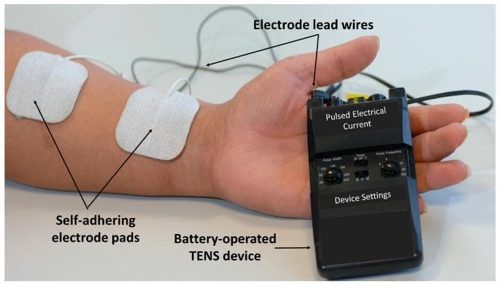 A clinical photograph illustrating a Transcutaneous Electrical Nerve Stimulation (TENS) setup for pain management. The image displays a portable, handheld, battery-operated TENS device held in a patient's hand. The device is black with physical control knobs for adjusting 'Pulse Width' and 'Pulse Frequency,' alongside a 'Timer' switch and a yellow intensity dial. Labeled electrode lead wires extend from the top of the device to two square, white, self-adhering electrode pads placed on the patient's anterior forearm. This procedural image demonstrates the correct positioning for delivering pulsed electrical currents across the skin's surface to stimulate peripheral nerves (A-beta fibers) for symptomatic pain relief. The visual focuses on the integration of hardware, skin interface, and user-adjustable settings in physical therapy and rehabilitation medicine.
