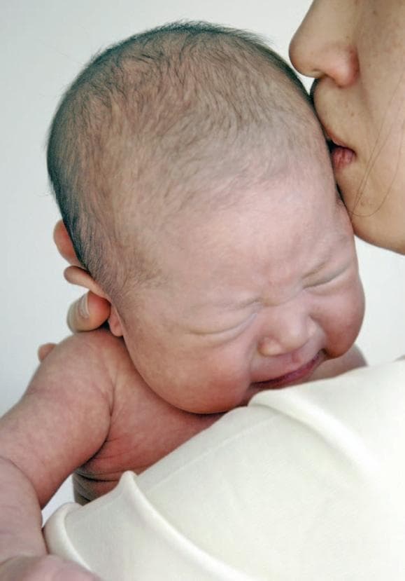 This clinical photograph depicts a newborn infant in a state of distress, being held by a caregiver. The infant exhibits a facial expression of crying or discomfort, characterized by tightly closed eyelids, a furrowed brow, and a slightly open, downturned mouth. The infant's skin shows a faint, physiologic mottling (cutis marmorata) on the upper extremities, which is a common finding in neonates due to vasomotor instability. The image serves as a visual reference for pediatric behavioral health and neonatal clinical assessment, specifically regarding infant temperament, soothability, and neurodevelopmental observation. It illustrates the physical manifestations of early emotional reactivity in a clinical or developmental psychology context.