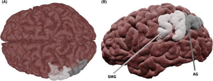 This medical anatomical diagram features a 3D surface-rendered model of the human brain, focusing on the cortical anatomy of the parietal lobe. The brain is presented in two panels: (A) a superior (top-down) view and (B) a lateral (side) view. The rendering utilizes a semi-transparent brown texture that highlights the gyri and sulci of the cerebral cortex. Specific anatomic regions associated with language and cross-modal processing are color-coded for educational identification. The supramarginal gyrus (SMG) is highlighted in opaque white, while the angular gyrus (AG) is highlighted in semi-transparent gray. In the lateral view (B), labels and indicator lines clearly demarcate these two adjacent regions, showing the SMG situated anteriorly to the AG within the inferior parietal lobule. This visualization is designed for neuroanatomical education, specifically to demonstrate the spatial relationship of parietal lobe structures involved in phonological processing and semantic integration, often studied via functional magnetic resonance imaging (fMRI) in clinical contexts like epilepsy or speech-language pathology.