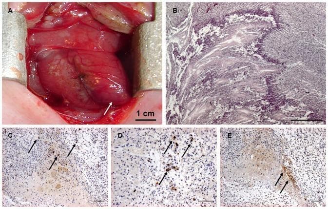 This composite educational image illustrates the macroscopic and microscopic features of an acute myocardial infarction (MI) in a fetal sheep model. Panel A is a clinical photograph showing the heart in situ during surgery; a white arrow indicates the anterior-apical region, which exhibits a distinct purple discoloration signifying acute ischemia and tissue necrosis. Panel B shows a Hematoxylin and Eosin (H&E) stained histological section (scale bar 500 μm) demonstrating myocardial necrosis characterized by loss of classical fiber morphology, nuclei, and cardiac proteins compared to healthy tissue. Panels C and D (scale bar 100 μm) utilize immunohistochemistry to show positive staining for activated caspase-3 (black arrows), a marker of the pro-apoptotic pathway. Panel E (scale bar 100 μm) presents a TUNEL assay (black arrows) identifying DNA fragmentation. Together, these panels demonstrate the progression of ischemic injury from gross vascular compromise to programmed cardiomyocyte cell death, providing essential visual markers for cardiovascular pathology and embryological research.