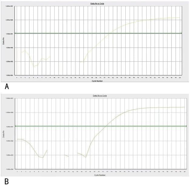 This diagnostic image displays real-time quantitative PCR (RT-qPCR) amplification curves, a key molecular biology technique used in hematology-oncology for detecting fusion genes and monitoring minimal residual disease. The figure is divided into two panels, A and B. Both panels plot Delta Rn (normalized fluorescence signal) on a logarithmic y-axis against Cycle Number on the x-axis, ranging from 1 to 45 cycles. A horizontal green threshold line is visible in both charts to define the cycle threshold (Ct) value. Panel A illustrates the amplification curve for the NUP98/RARG fusion gene, showing baseline fluctuations followed by an exponential increase starting around cycle 21 and reaching a plateau after cycle 35. Panel B depicts the amplification of the ABL control gene, showing a characteristic sigmoidal curve that crosses the threshold at approximately cycle 22. These curves provide visual evidence of a positive NUP98/RARG rearrangement in a clinical sample, likely from a patient with an atypical acute promyelocytic leukemia (APL) phenotype where traditional PML-RARA fusions are absent.