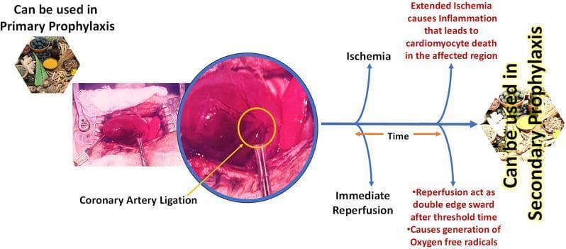 This medical infographic illustrates the experimental induction and pathophysiology of Myocardial Ischemia-Reperfusion Injury (MIRI) in an in vivo model. On the left, a clinical photograph displays a surgical field where coronary artery ligation is performed on an exposed heart; a circular inset uses an arrow to highlight the precise site of vessel occlusion. To the right, a horizontal timeline diagram outlines the resulting pathological sequence. The initial ligation leads to ischemia, which if extended, triggers inflammation and subsequent cardiomyocyte death. The diagram also illustrates 'Immediate Reperfusion' as a 'double-edged sword' that, after a threshold time, causes the generation of oxygen-free radicals (reactive oxygen species). The flowchart integrates pharmacological intervention points, indicating where natural compounds (likely flavonoids based on the icons) can be utilized in 'Primary Prophylaxis' prior to the ischemic event or 'Secondary Prophylaxis' during the reperfusion phase. This visual resource is designed to teach the mechanisms of acute cardiac injury and the potential role of antioxidants in cardiovascular protection.