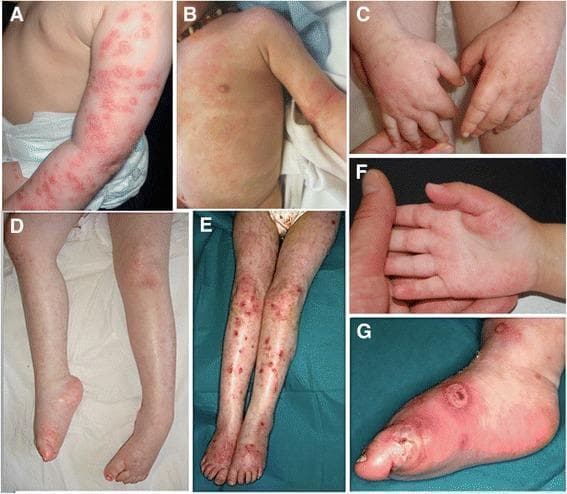 Hugging Face pmc clinical VQA raw