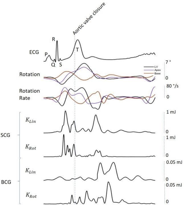 This physiological signal diagram illustrates the temporal synchronization of cardiac mechanical and electrical events over a single heart cycle. The visualization includes seven aligned waveforms: (a) a standard lead ECG with labeled P-Q-R-S-T complexes; (b) Left Ventricular (LV) rotation mechanics showing apical (purple), basal (brown), and net LV twist (black) in degrees; (c) corresponding rotation rates in degrees per second; (d-e) Seismocardiogram (SCG) representing linear (KLin) and rotational (KRot) kinetic energy in millijoules (mJ); and (f-g) Ballistocardiogram (BCG) also representing KLin and KRot energy. A vertical dashed line indicates Aortic Valve Closure (AVC). The diagram highlights key pathophysiological relationships: SCG energy peaks bimodal, occurring during the ejection phase (pre-AVC) and early diastole (post-AVC), while BCG energy peaks appear almost exclusively during the diastolic phase (post-AVC). This chart serves as an educational tool for understanding the relationship between electrical conduction, myocardial rotational mechanics, and the kinetic energy generated by cardiac micro-accelerations and body displacements.