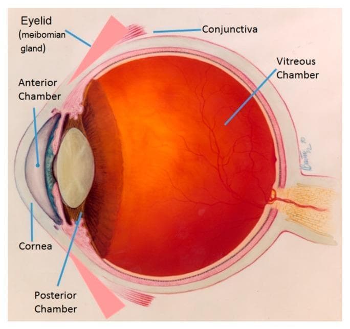 This medical anatomical diagram provides a cross-sectional view of the human eye, illustrating key ocular structures and chambers. In the anterior segment, labeled components include the eyelid with the meibomian gland, the cornea, and the fluid-filled anterior and posterior chambers. The iris and crystalline lens are visible, demarcating the boundary between the anterior and posterior sections. The posterior segment is dominated by the vitreous chamber, depicted with a reddish-orange hue representing the fundus. Within this chamber, the retinal vasculature is shown branching across the inner surface, with the optic nerve head visible at the posterior pole. Additional labels identify the conjunctiva and the layers of the ocular wall. This illustration is designed for basic to intermediate medical education, emphasizing the spatial relationships between ocular compartments and providing clinical context for conditions such as meibomian gland dysfunction, dacryocystitis, and retinal health.