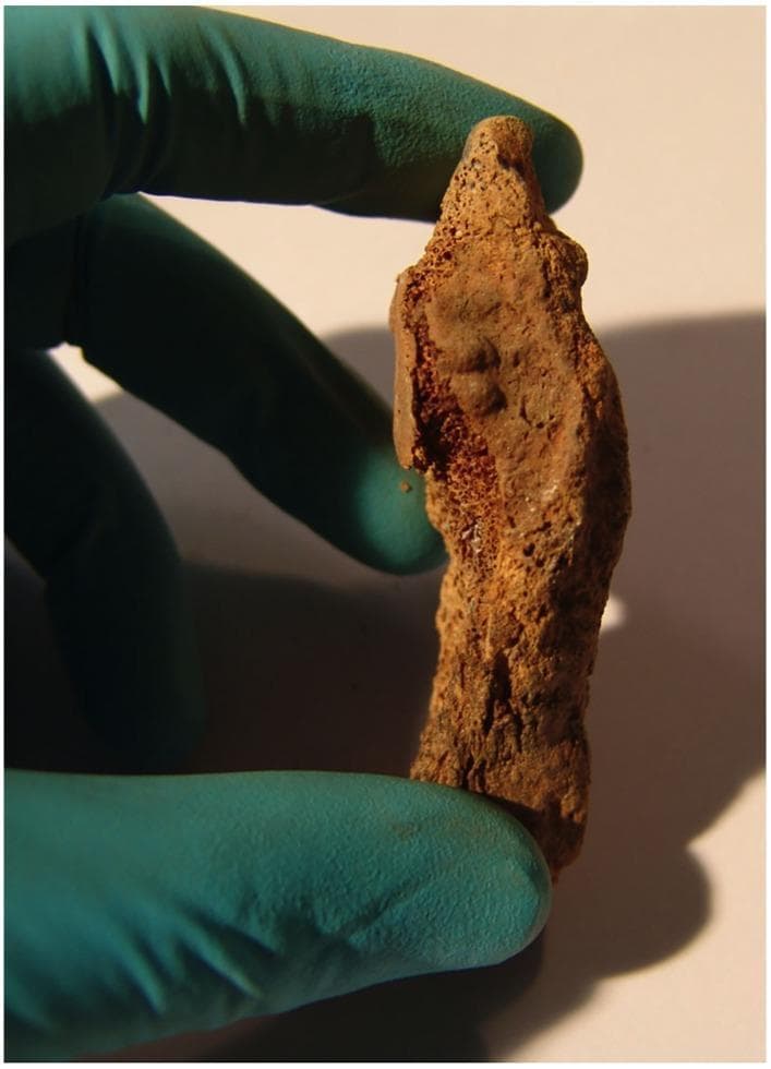 A clinical photograph of a specimen showing the symphyseal face of a left pubic bone fragment, held by a gloved hand. This osteological specimen is used for forensic age estimation based on morphological changes of the pubic symphysis. The visual features include well-marked ridges and furrows across the symphyseal surface, along with the early formation of a rim on both the ventral and dorsal margins. These specific age-related metamorphic changes are consistent with Stage II of the Acsádi and Nemeskéry classification system, typically indicating an adult individual in early to mid-middle age. The bone shows signs of weathering and mineralization changes common in exhumed skeletal remains. The image serves as an educational example of forensic anthropology and skeletal biology methods for determining biological profile in archaeological or forensic contexts.