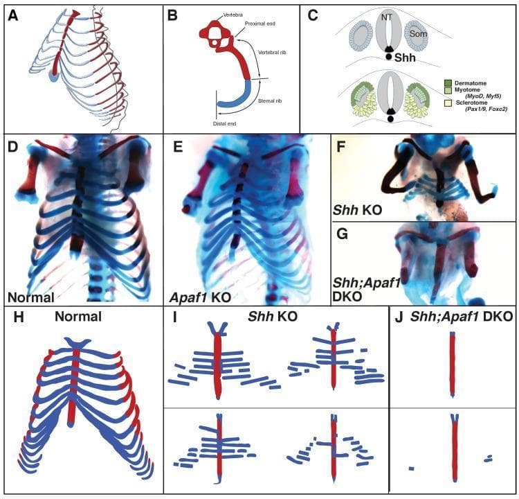 This composite educational graphic details rib cage development and skeletal defects in mouse embryos. Panel A provides a 3D perspective of the thoracic cage, while Panel B is a schematic defining the anatomy: the proximal/vertebral rib (bone, red) and distal/sternal rib (cartilage, blue). Panel C illustrates somite differentiation into dermatome, myotome, and sclerotome, highlighting Shh expression from the notochord. Panels D-G show E18.5 skeletal preparations using Alizarin red (bone) and Alcian blue (cartilage). Normal (D) and Apaf1 KO (E) embryos show 13 intact rib pairs and vertebrae. Shh KO (F) embryos display complete absence of vertebrae and proximal ribs, with mispatterned, discontinuous distal cartilaginous ribs. Shh;Apaf1 DKO (G) embryos exhibit the most severe phenotype, lacking both vertebrae and nearly all rib elements, leaving only the ossified sternum. Panels H-J provide stylized schematics summarizing these phenotypes. The visual highlights the essential role of Sonic Hedgehog signaling in sclerotome induction and the patterning of the proximal-distal axial skeleton.