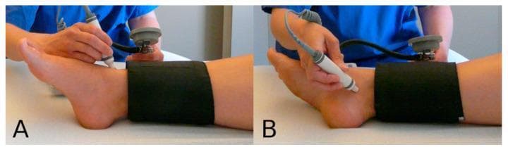 A two-panel clinical photograph demonstrating the procedural technique for measuring the Ankle-Brachial Index (ABI) using a handheld Doppler probe and a sphygmomanometer. In both images, a black pneumatic blood pressure cuff is wrapped around the distal lower leg superior to the malleoli. Panel A illustrates the assessment of the anterior tibial artery, with the Doppler probe positioned on the anterior aspect of the ankle. Panel B shows the assessment of the posterior tibial artery, with the probe positioned on the posterior-medial aspect of the ankle near the medial malleolus. An examiner is shown holding the probe at an appropriate angle to detect arterial flow while monitoring the pressure gauge attached to the cuff. This procedural visual serves as an educational guide for vascular assessment, specifically in screening for peripheral artery disease (PAD) by identifying systolic pressure at specific anatomical landmarks.