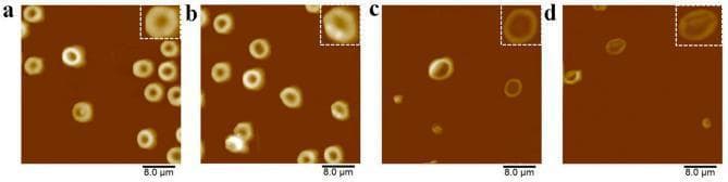 Atomic Force Microscopy (AFM) images depicting the morphological assessment of C57BL/6 mouse blood cells to evaluate the biocompatibility of RGDV-gemcitabine. The image is divided into four panels (a–d), each with a scale bar of 8.0 μm and a locally amplified inset. Panels (a) and (b) show erythrocytes (red blood cells) in ultrapure water (control) and treated with 1 mM RGDV-gemcitabine, respectively. In both conditions, the erythrocytes maintain a characteristic biconcave, ring-like morphology with smooth surfaces, indicating no significant cytotoxic structural damage. Panels (c) and (d) display leucocytes (white blood cells) under the same control and experimental conditions. The leucocytes appear as larger, somewhat more irregular ring-like structures compared to erythrocytes, but likewise retain a smooth surface texture following RGDV-gemcitabine treatment. The background in all AFM topographical maps is a uniform dark brown, highlighting the brighter, elevated cellular structures. These diagnostic images are used in pharmacological research to demonstrate that the RGDV-gemcitabine conjugate does not adversely affect the surface morphology of healthy hematopoietic cells.